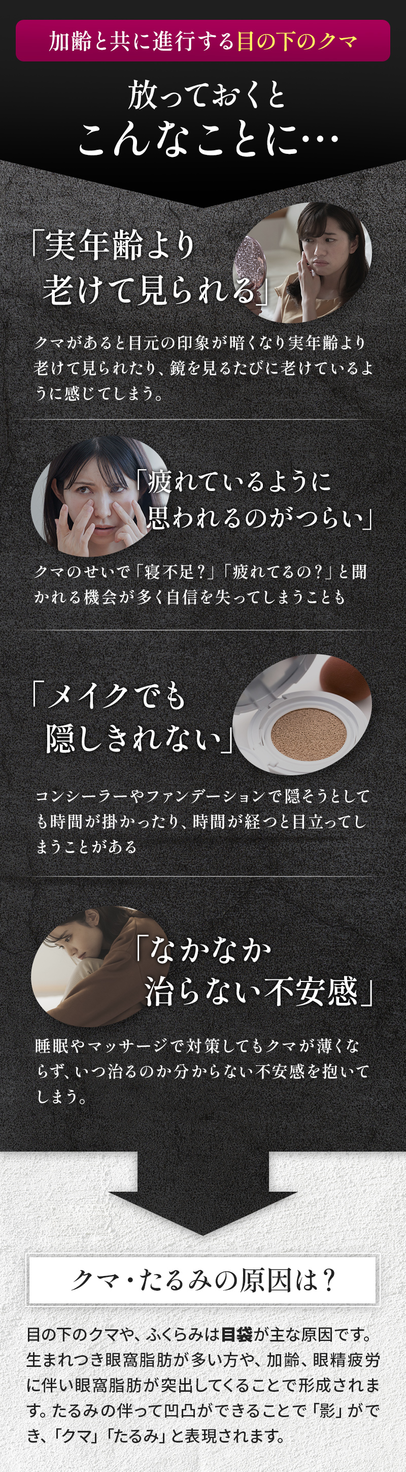 加齢と共に進行する目の下のクマ。放っておくとこんなことに…。「実年齢より老けて見られる」「疲れているように思われるのがつらい」「メイクでも隠しきれない」「なかなか治らない不安感」クマ・たるみの原因は？